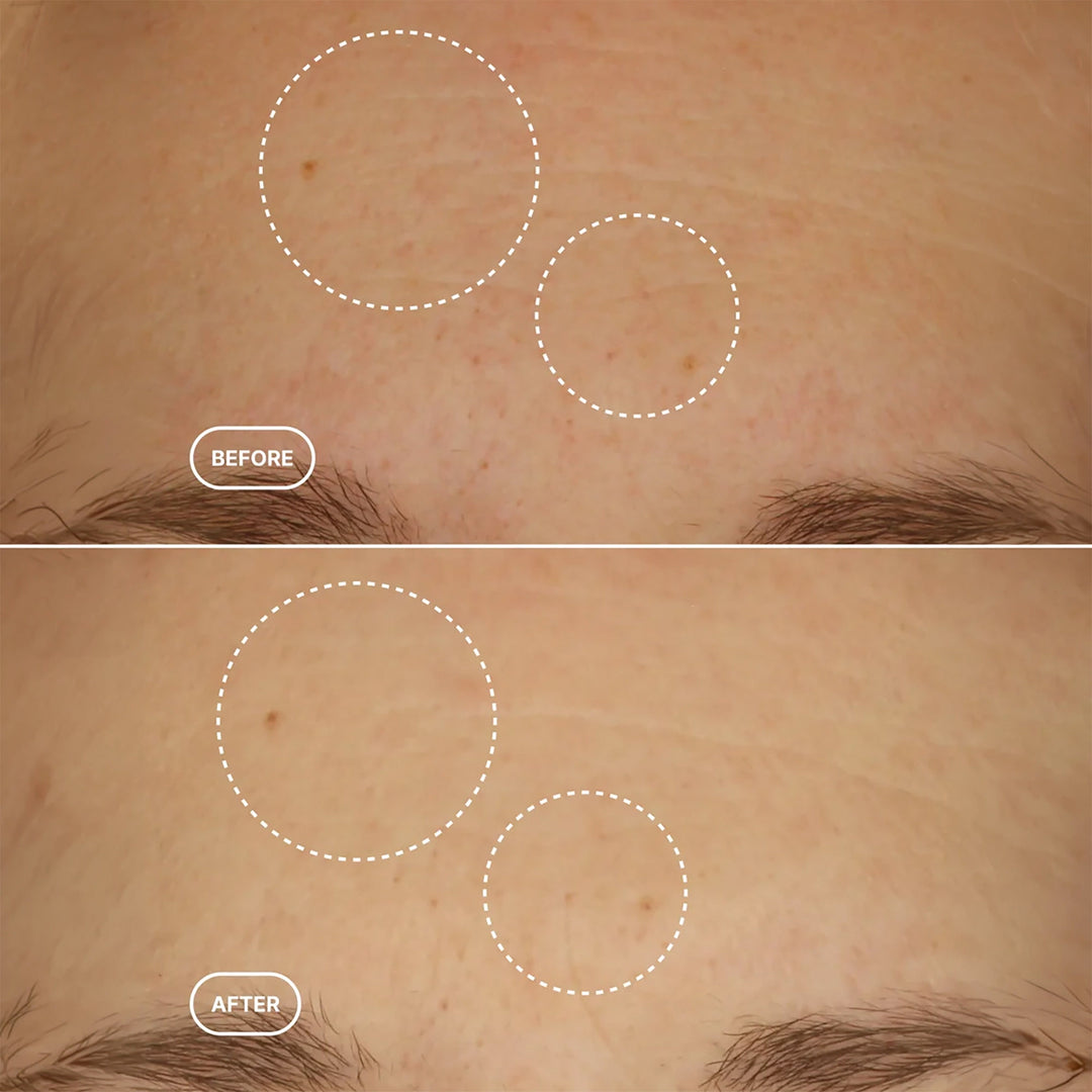 Retinol Alternative Serum - 30ml